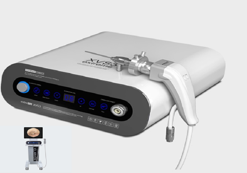 MÁY NỘI SOI TAI MŨI HỌNG XVS3