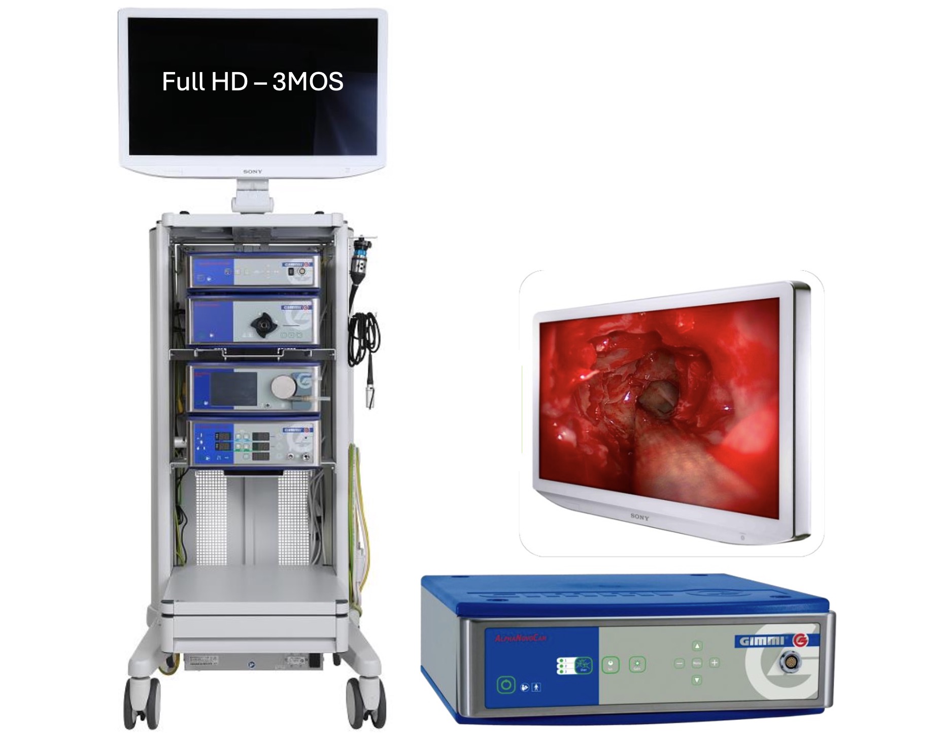 Hệ thống phẫu thuật nội soi Full HD